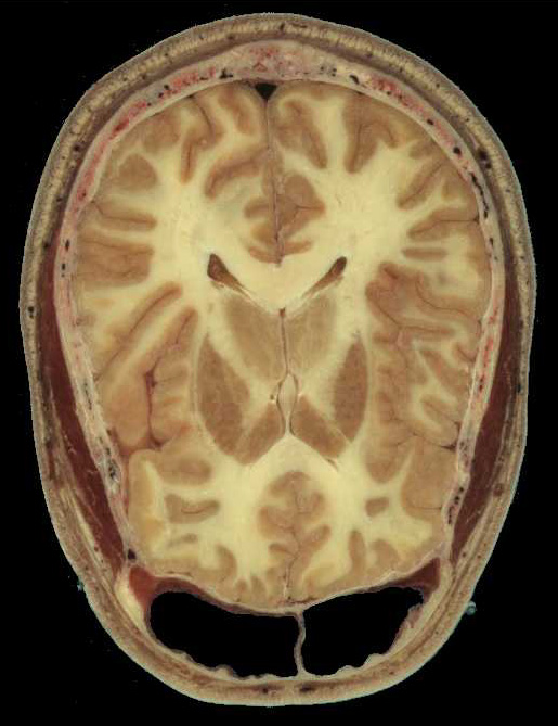 head2.jpg- Click to view